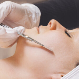 Dermaplaning
