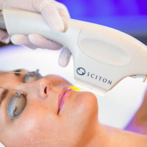 IPL (Intense Pulsed Light)